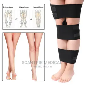 Bowed Legs Braces Correction Belt Knee Pad Support