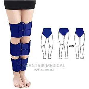 X/O Leg Correction Belt Legs Straightening Bow Legs
