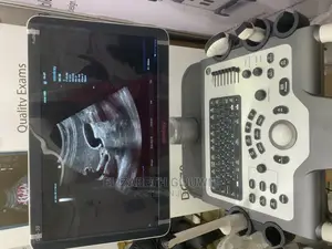 Mindray DC30FULLHD Ultrasound Machine