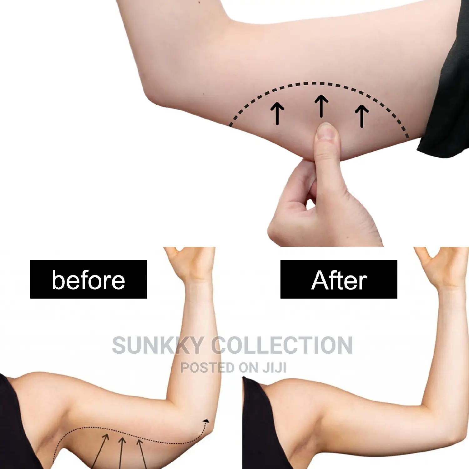 Harbal Thin Arm Patch Weight Loss Stickers Cellulite Removal