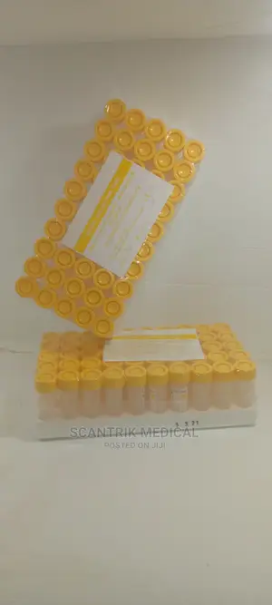 Fluoride/Oxalate Glucose Blood Collection Tube for Hospital