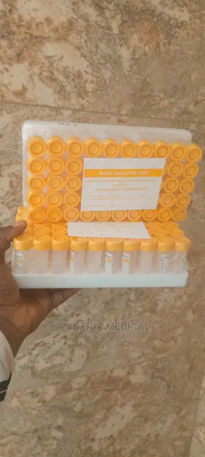 Blood Collection Glucose(Fluoride-Oxalate) Tube