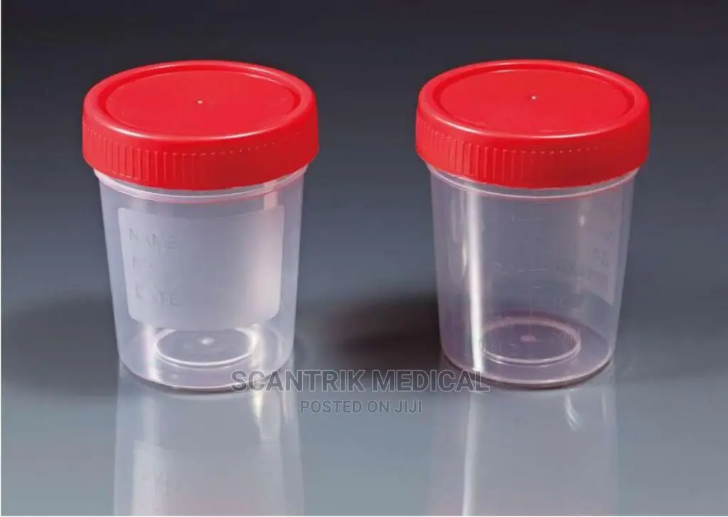 Plastic Stool/Urine Specimen Containers
