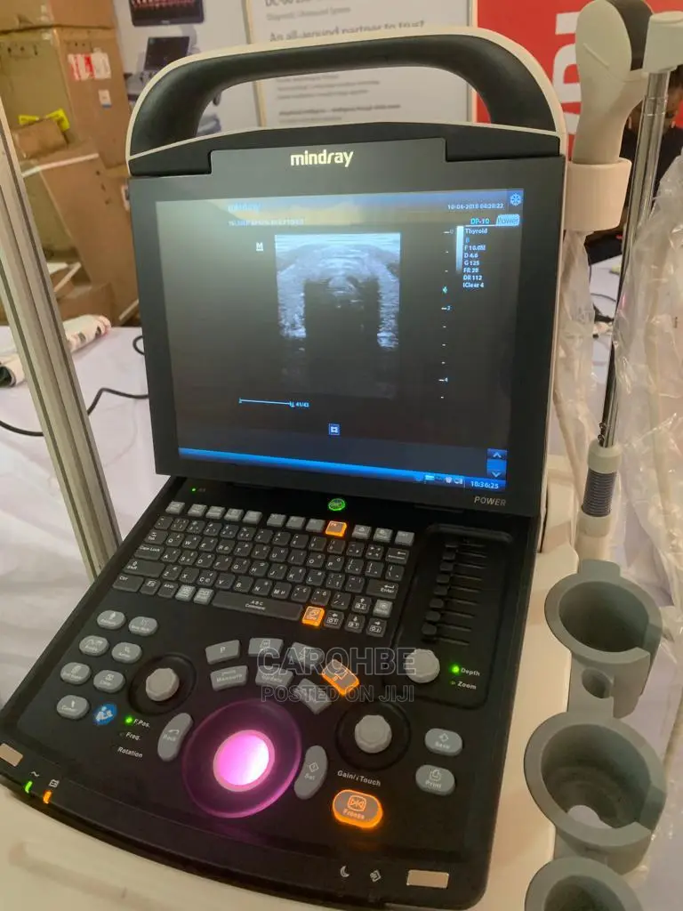 Ultrasound Machine