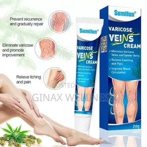 Varicose Veins Cream | Spider Veins Treatment Cream