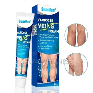 Varicose Veins Cream | Spider Veins Treatment Cream