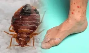 Most Wanted Bed Bug Killer: Top Rated!