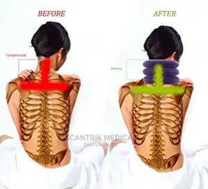 Cervical Collar Sports Equipment