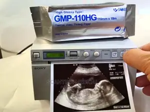 Medical Ultrasound Printer