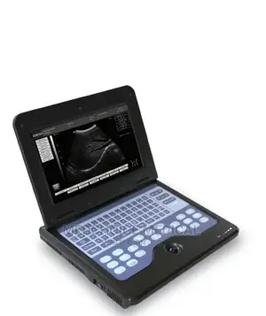 Portable Laptop Ultrasound