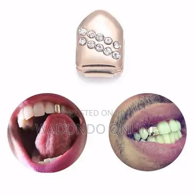 Gold Plated Small Single Tooth Cap Grillz