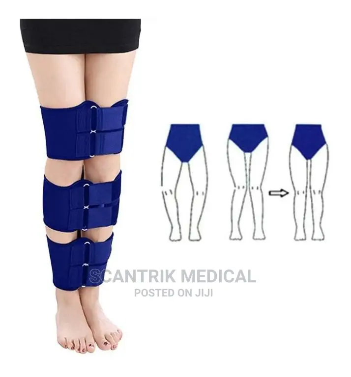 Bow Leg Correction