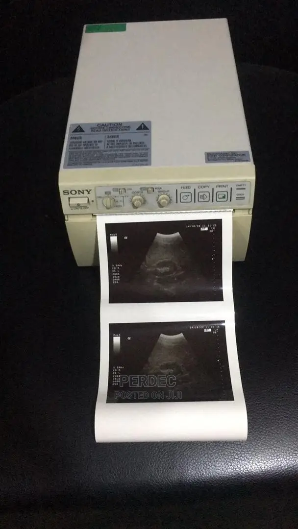 Digital Colour Printer for Ultrasound Machine