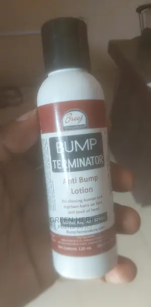 Bump Terminator Lotion (For Back-Head Bump)