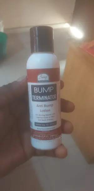 Bump Terminator Lotion (For Back-Head Bump)