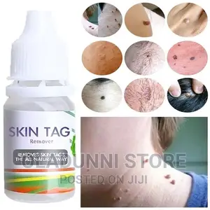 Tag Removal