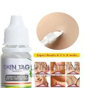 Tag Removal