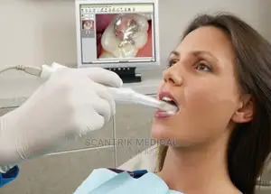 Dental Intraoral Oral Camera HD
