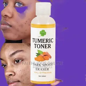 Photo - Turmeric Face Toner | Dark Spots Eraser And Acne Removal