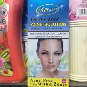 Acen Solution Treatment Soap
