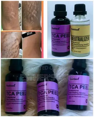 TCA Chemical Acid Peel for Stretch Marks