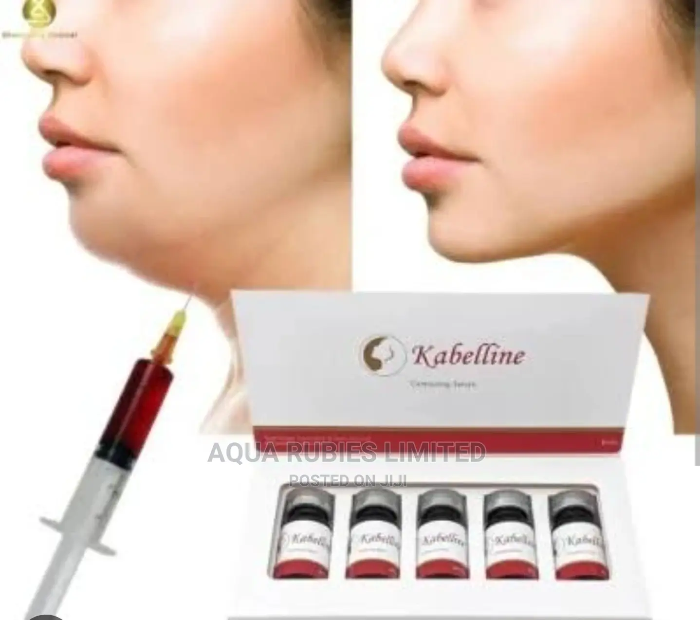 Kabelline Facial Fat Reduction Injection in Ikeja Vitamins