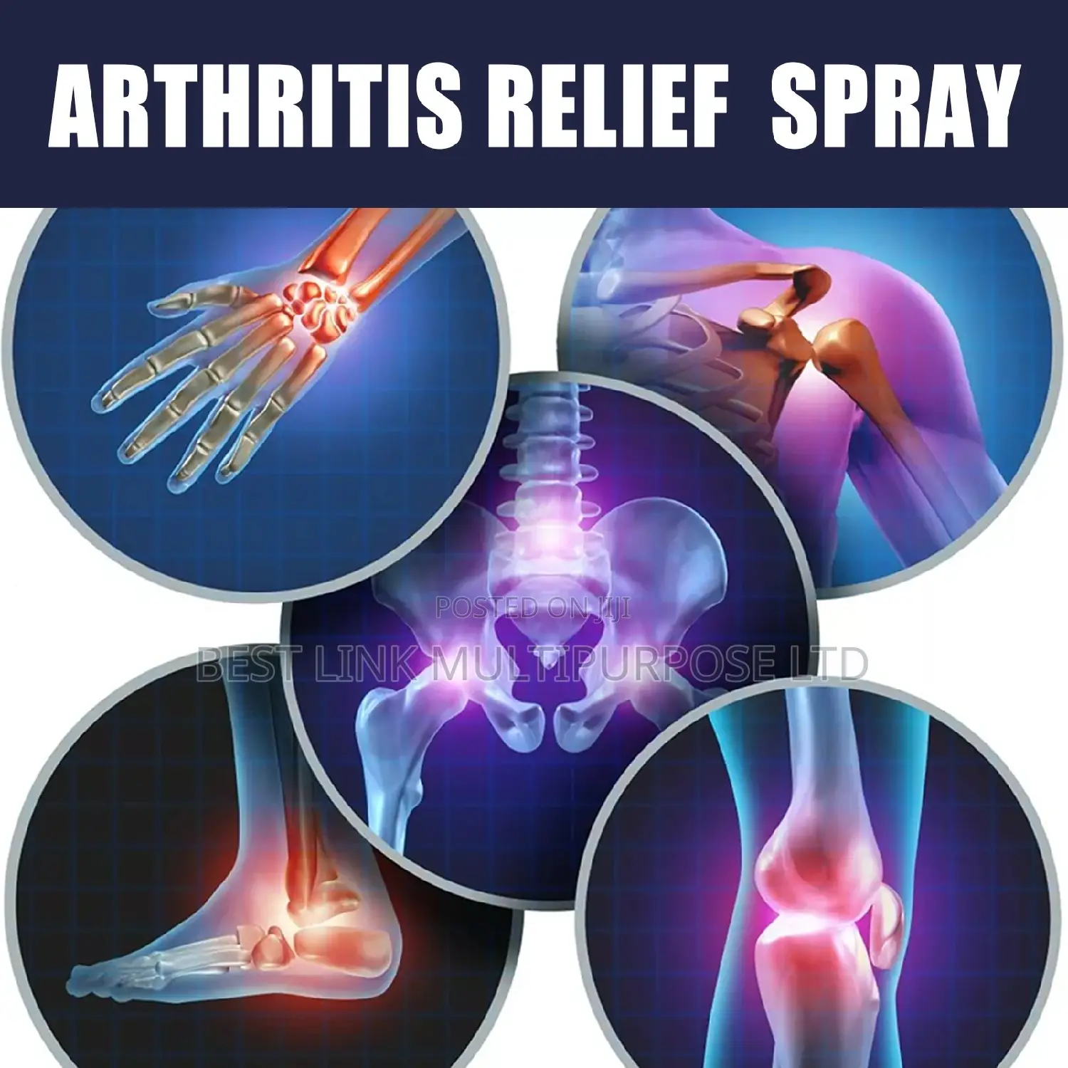 Arthritis And Joint Relief Spray