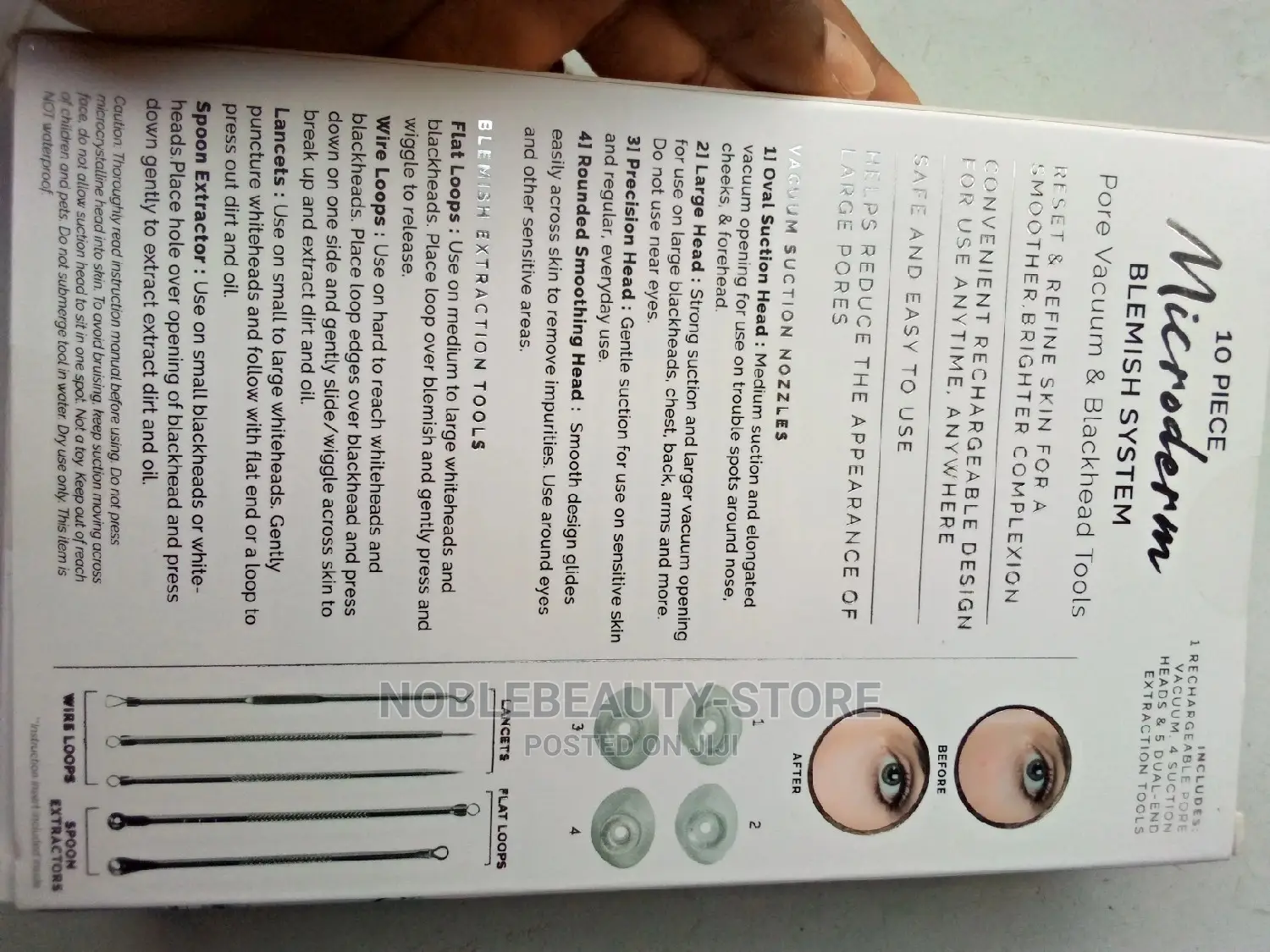 Microderm Blemish Pore Extractor Kit