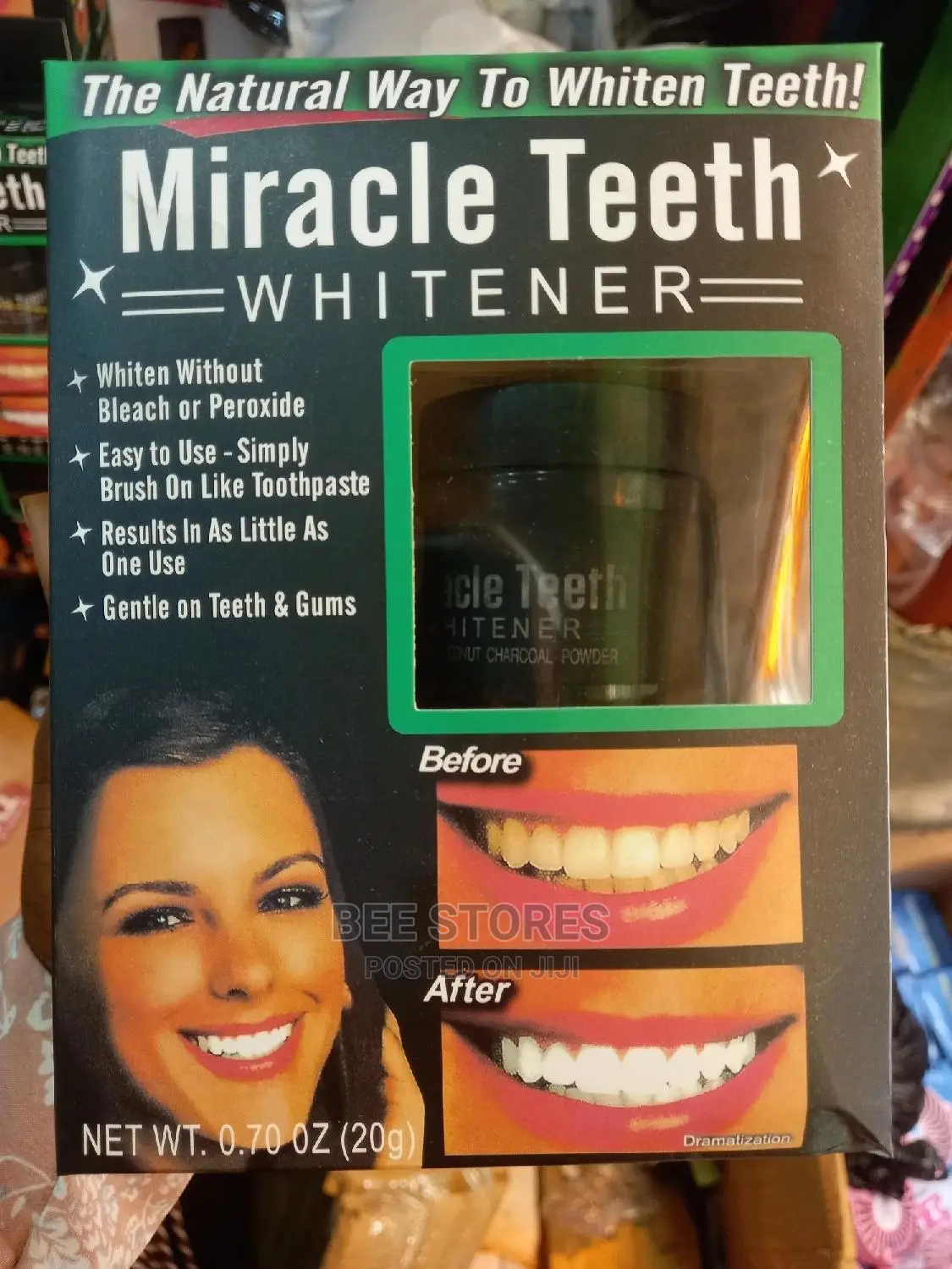 Miracle Teeth Withening