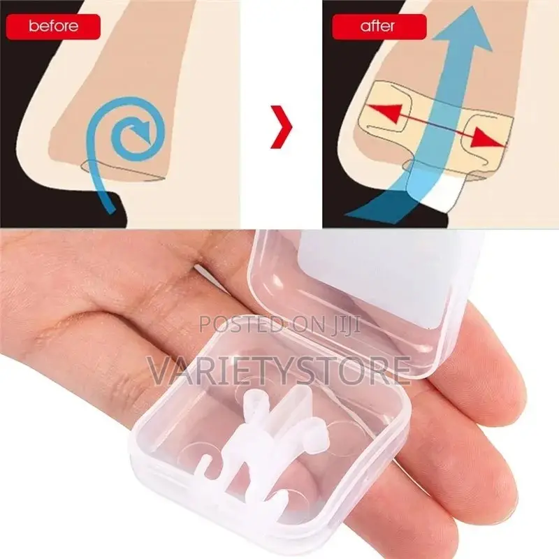Anti-Snoring Device