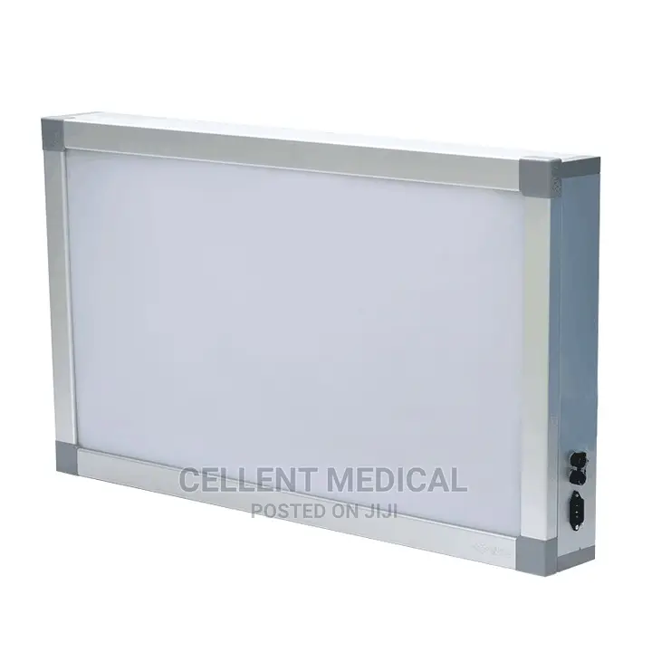 X-Ray View Box