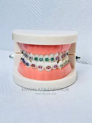 Photo - Quality Denta Braces