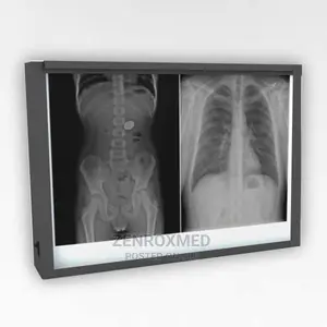 LED Double X-Ray Viewing Box