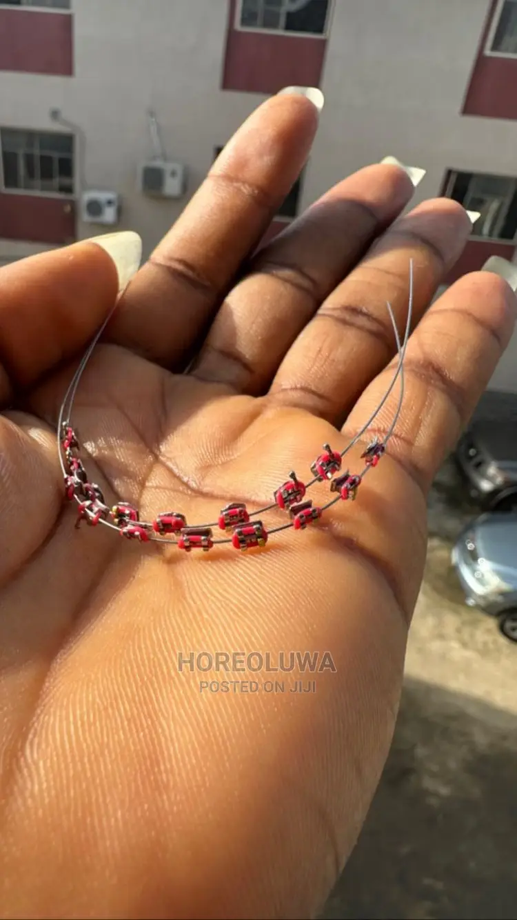 Teeth Braces in Ibadan Jewellery, Promise Olatunde Jiji.ng