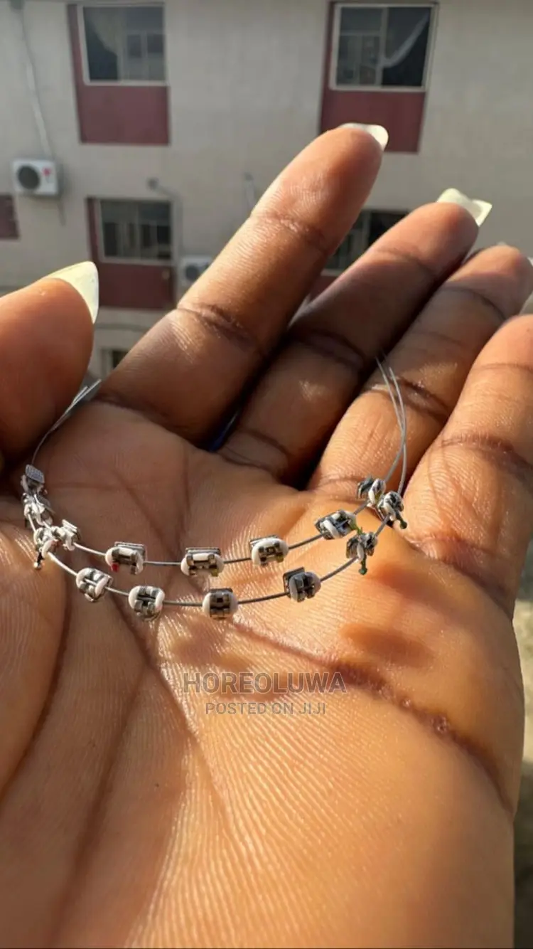 Teeth Braces in Ibadan Jewellery, Promise Olatunde Jiji.ng
