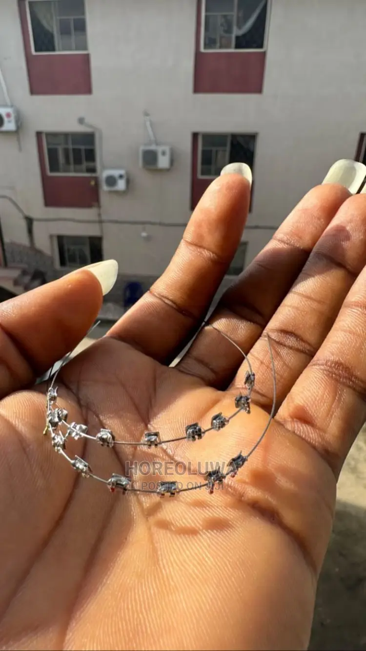 Teeth Braces in Ibadan Jewellery, Promise Olatunde Jiji.ng