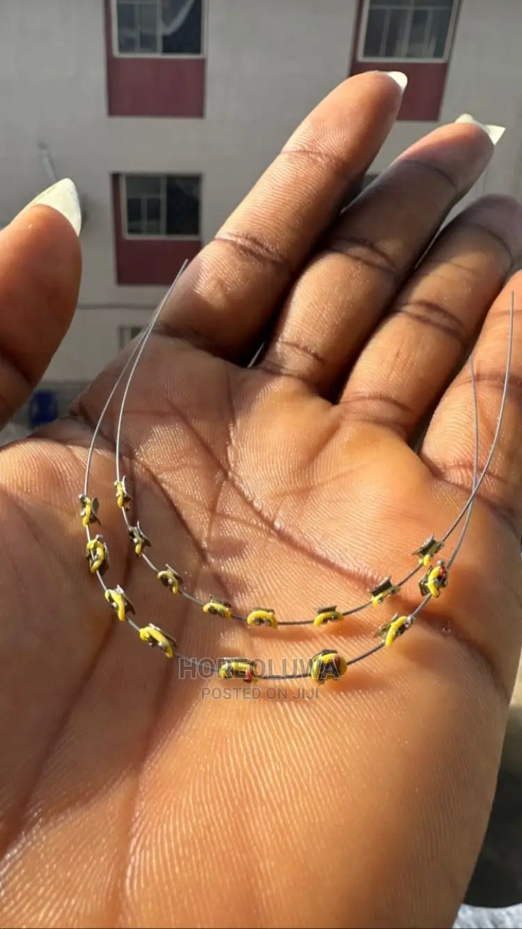 Teeth Braces in Ibadan Jewellery, Promise Olatunde Jiji.ng