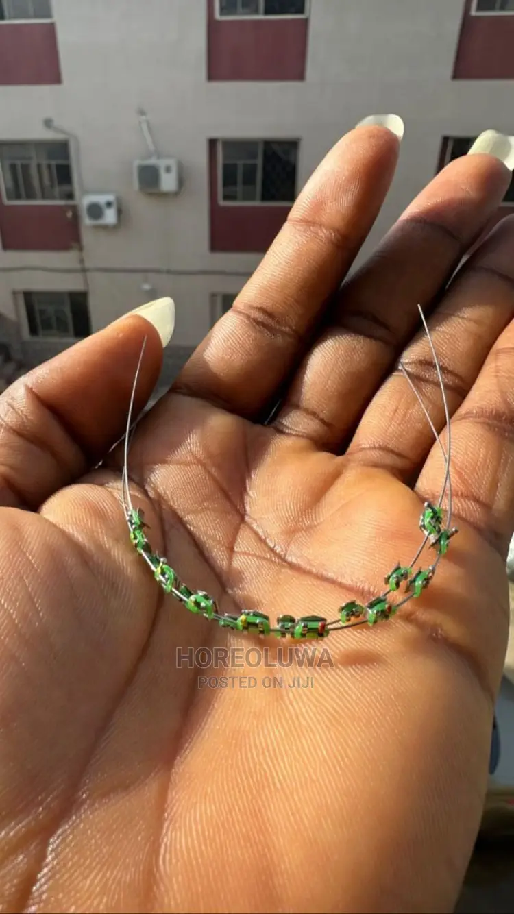 Teeth Braces in Ibadan Jewellery, Promise Olatunde Jiji.ng