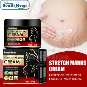 Stretch Marks Removal Cream