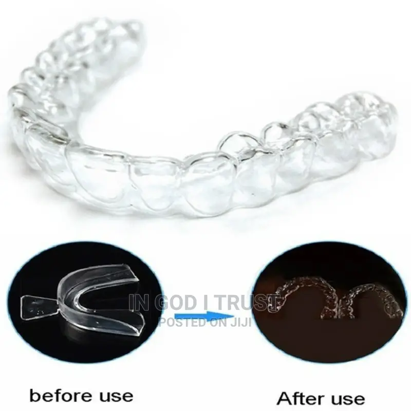 2 Pairs Stop Snoring Anti Snore Mouthpiece