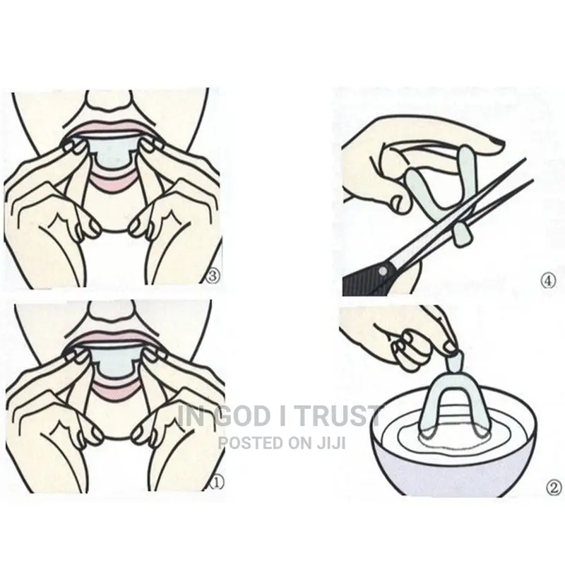 2 Pairs Stop Snoring Anti Snore Mouthpiece
