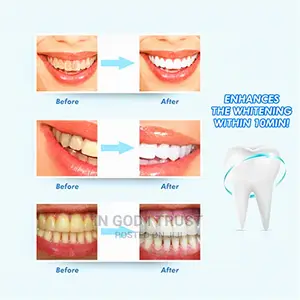Teeth Whitening Kit With Led Light