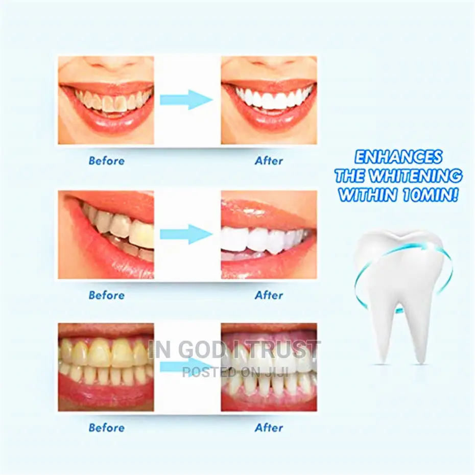 Teeth Whitening Kit With Led Light
