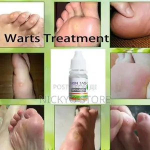 Skin Tag Removal