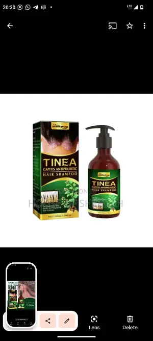 Tinea Capitis Antipruritic Shampoo