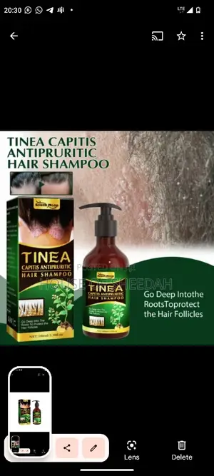 Tinea Capitis Antipruritic Shampoo