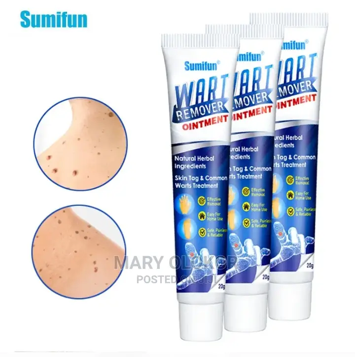 Sumifun Wart Removal