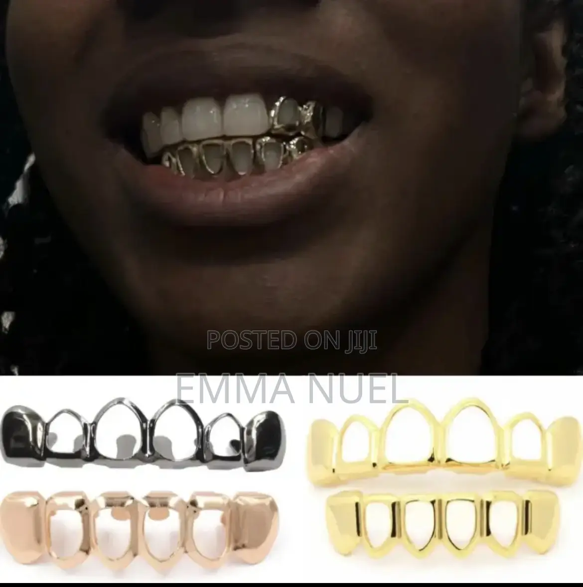 Gold Teeth