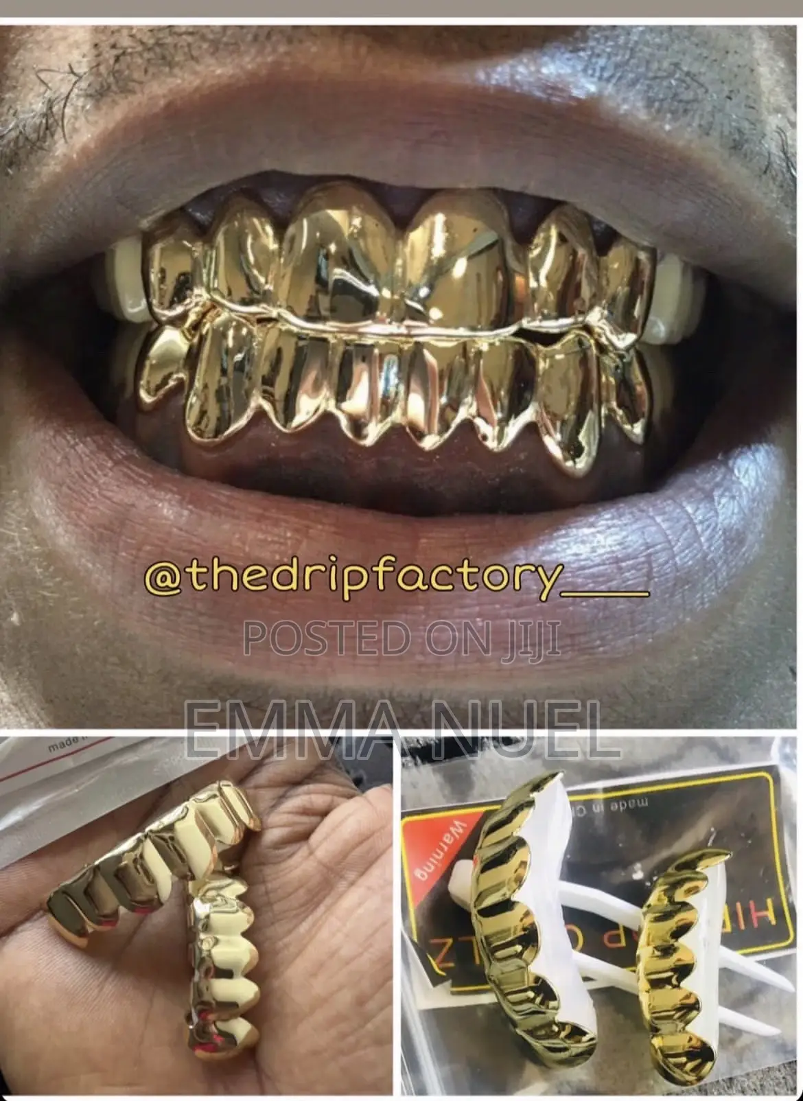 Gold Teeth