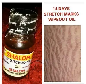 Photo - Shalom Stretch Marks Oil.